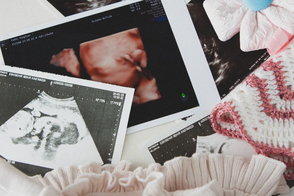 Baby-Photo Guessing Game around a seasonal color palette — celebrations · Baby Showers