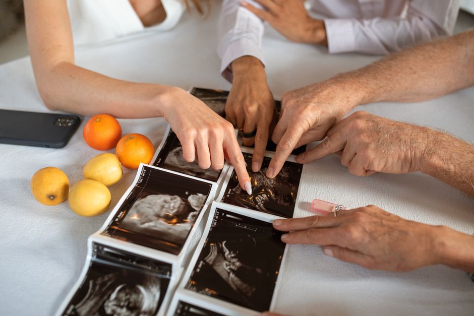 25 Baby-Photo Guessing Game ideas for getting guests involved