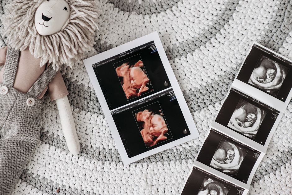 Baby-Photo Guessing Game for an outdoor celebration — celebrations · Baby Showers